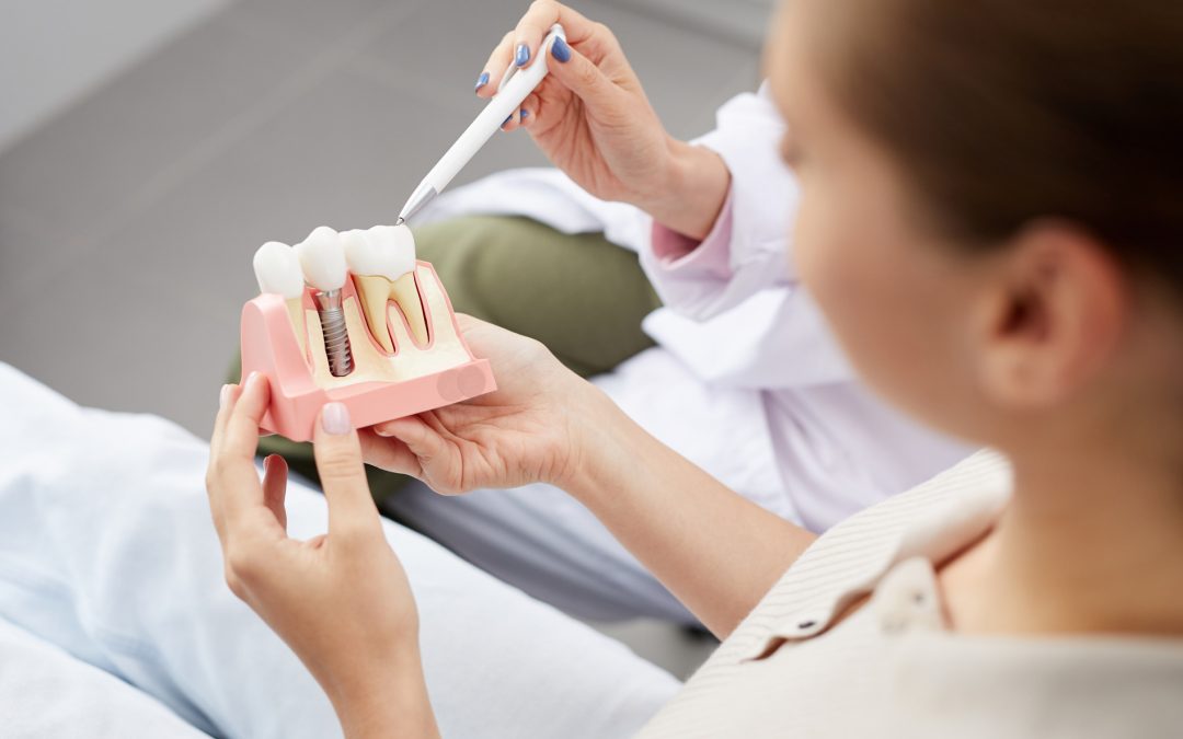 Dental Implants: Are They Cosmetic, Covered, and Worth It?