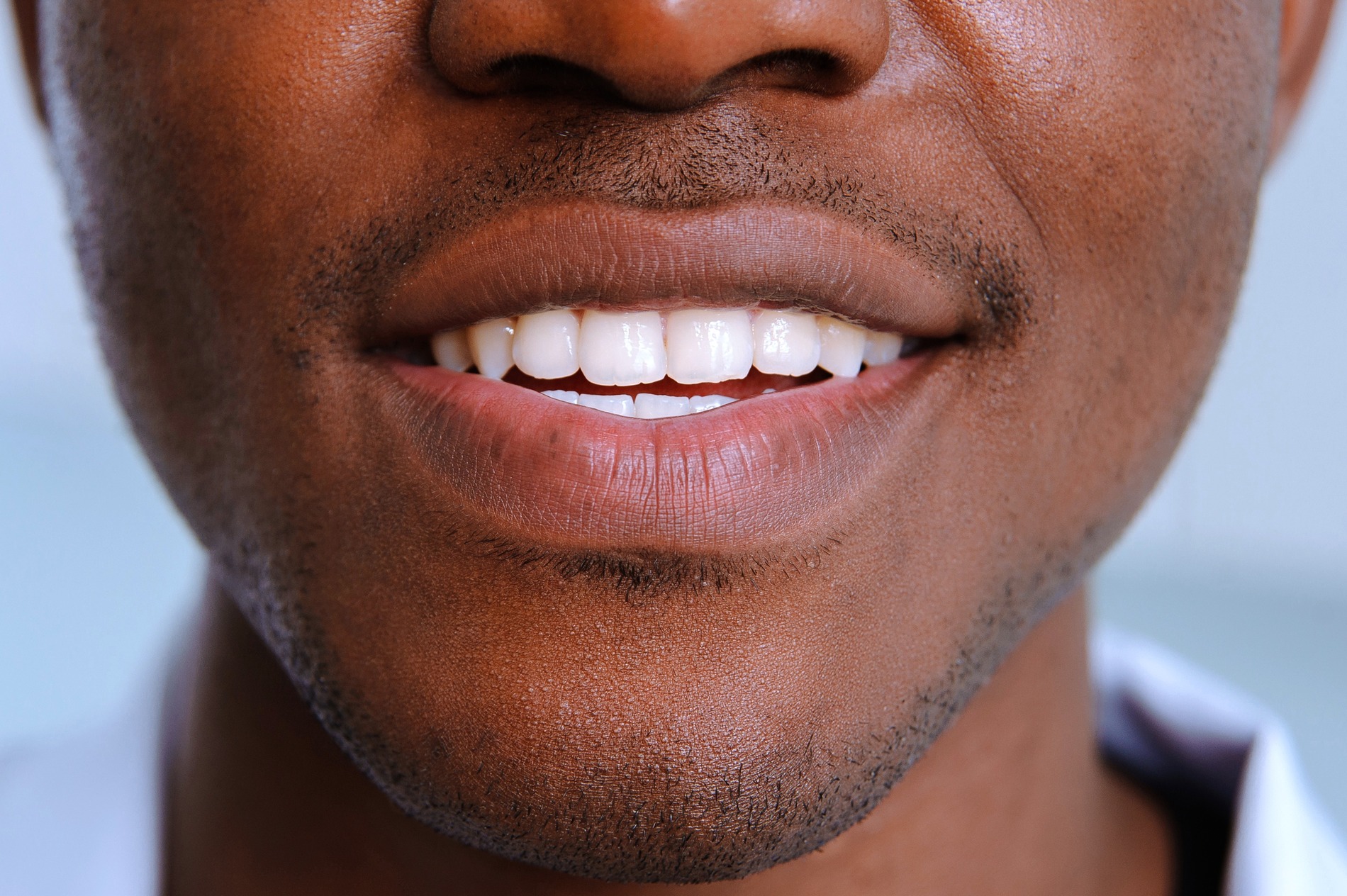 Man with white teeth after professional whitening treatments in Fargo ND
