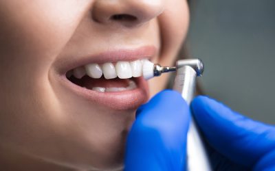 What Happens During a Complete Oral Exam at the Dentist in Fargo, ND?